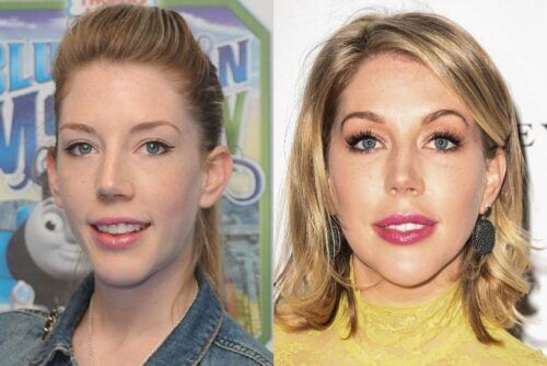 Katherine Ryan Plastic Surgery Clinic Mono