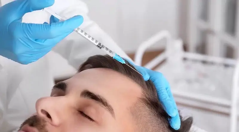 Choosing the right clinic for hair transplant
