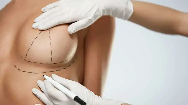 What is breast uplift?
