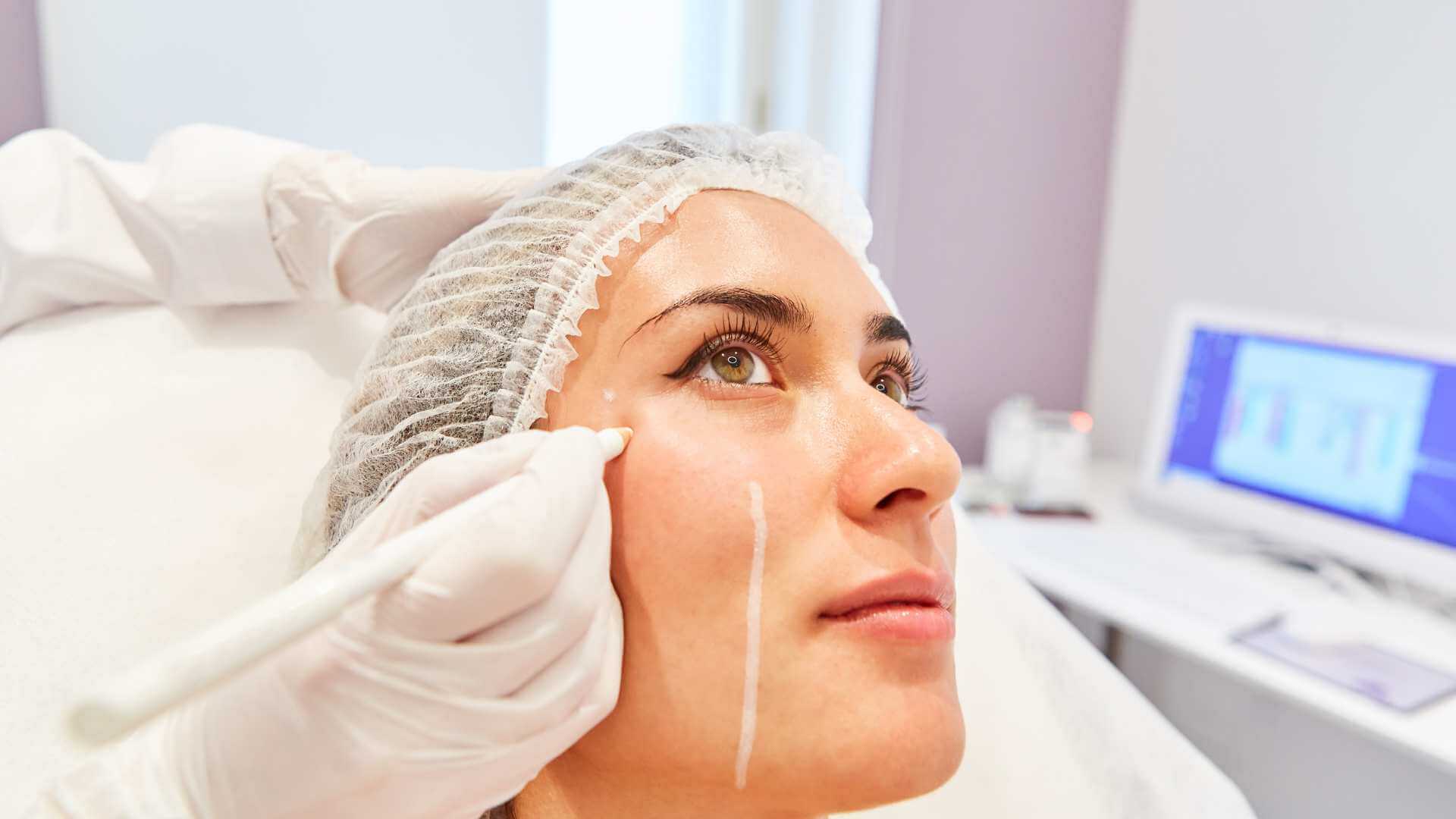 Facelift Cost Turkey Botox / Mini Facelift Turkey Reviews