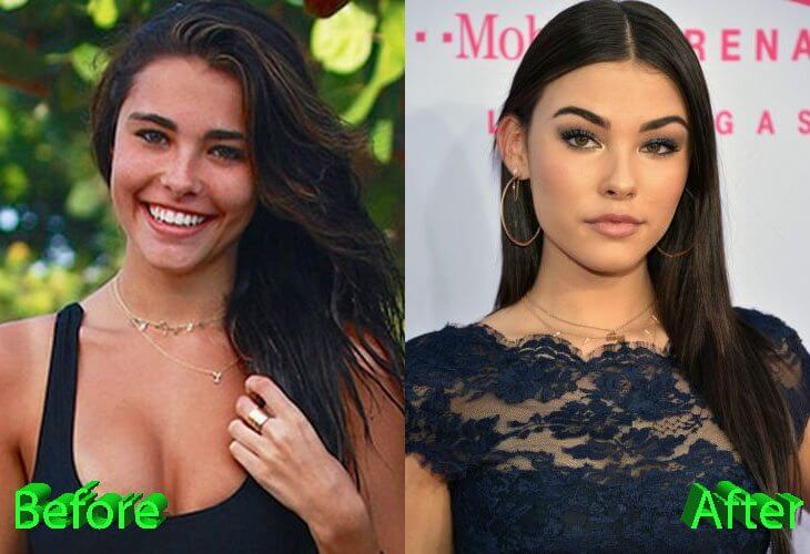 madison beer before and after