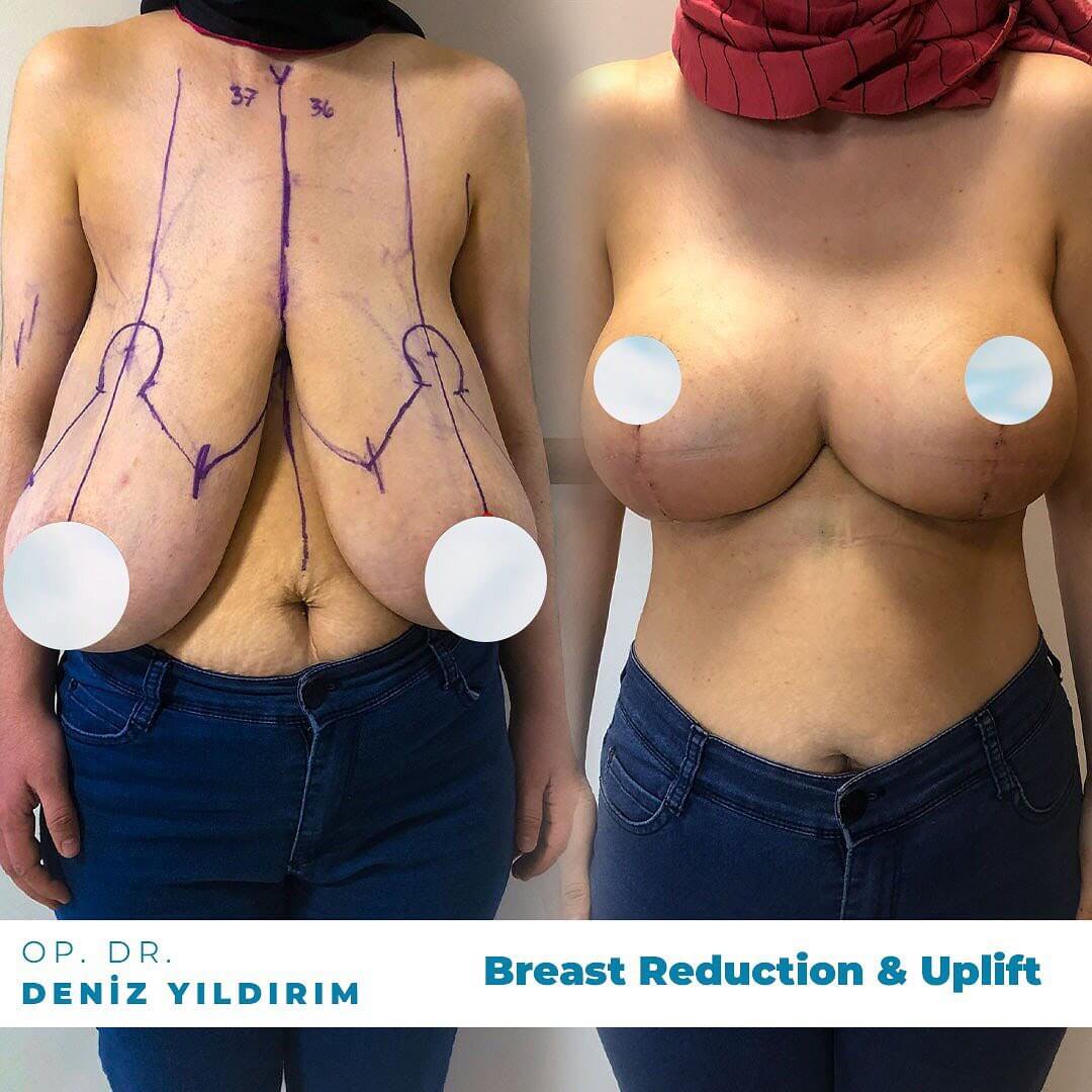Department: plastic, reconstructive and aesthetic surgery Snapinsta. App_323927562_1596455667460926_5071283421804295884_n_1080