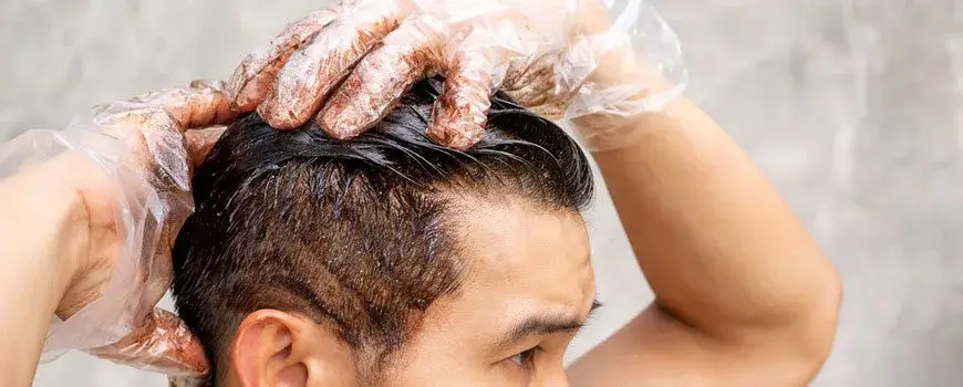 Can-you-dye-your-hair-after-hair-transplant