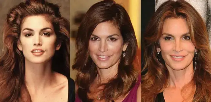 Cindy crawford botox before & after photos