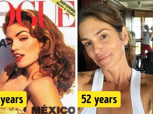 Cindy-crawford-plastic-surgery|cindy crawford botox before & after photos