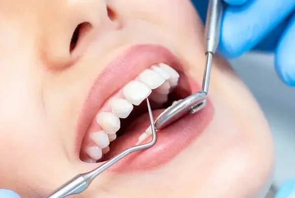 cosmetic-denstry-turkey