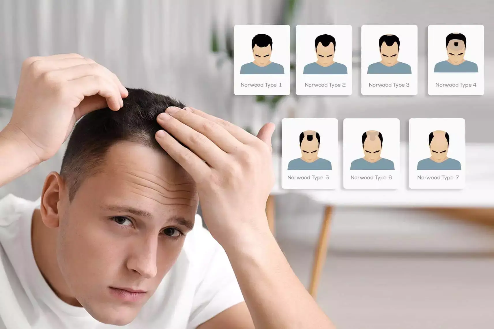 How Long Does a Hair Transplant Last? Clinic Mono