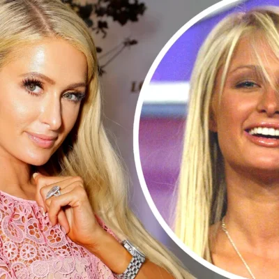 Paris hilton plastic surgery