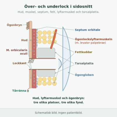 Hud, ringmuskel, septum, fettkuddar, lyftarmuskelns sena och tarsus ligger i lager. Ögonbrynet sitter ovanför ögonlocket.